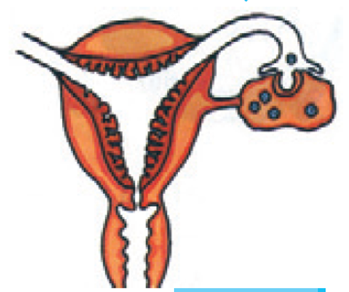 siklus menstruasi