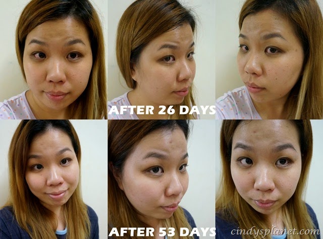 [Visapure%2520review%25204%255B3%255D.jpg.webp]