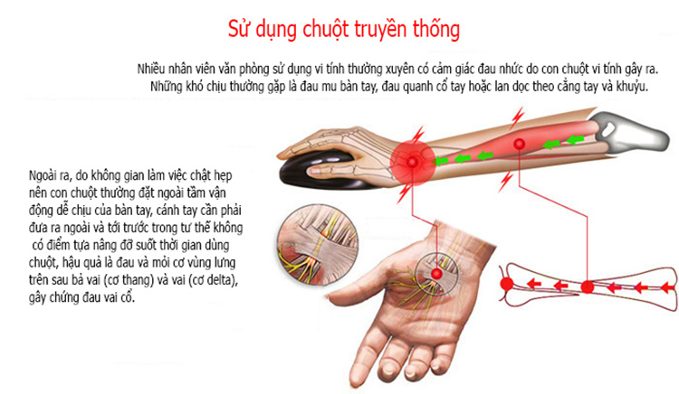 chuột máy tính Chuột dọc không dây Sungi