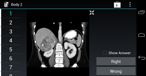 Radiology Flashcards: Body 2