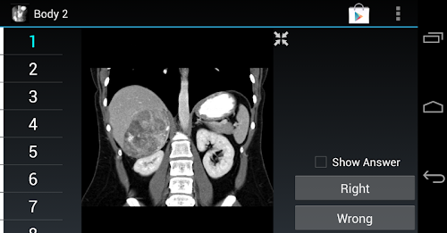 Android application Radiology Flashcards: Body 2 screenshort
