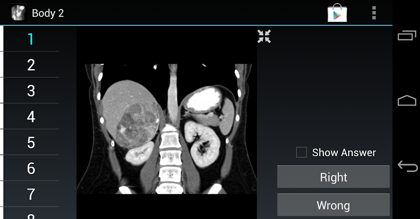 Radiology Flashcards: Body 2 Screen 1