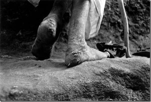 Feet of pilgrim deacon that come to Lalibela for third time , from Woldya, five days far away. Everyday and during two weeks this deacon pray in San Michael church during six hours. 