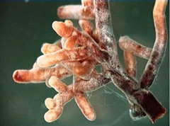 Mycorrhizal Root Tips