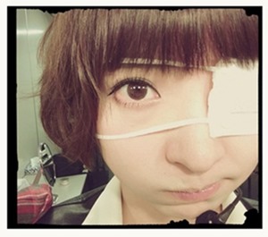 篠田麻里子＿眼帯