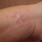 Pele - jun 2009  P6170061.JPG