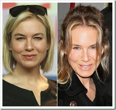 renee-zellweger-plastic-surgery-experts-say-ftr