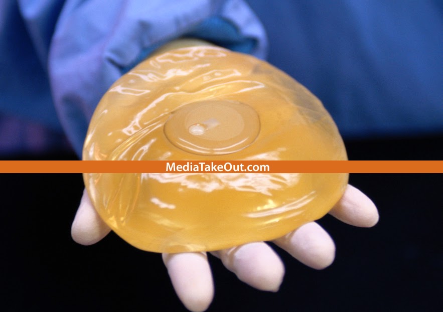 Woman's butt implants explode after a night with her boyfriend. STORY ! STORY !! STORY