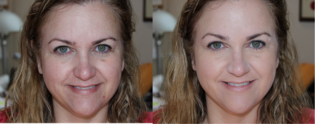 Before After OCC Skin Conceal