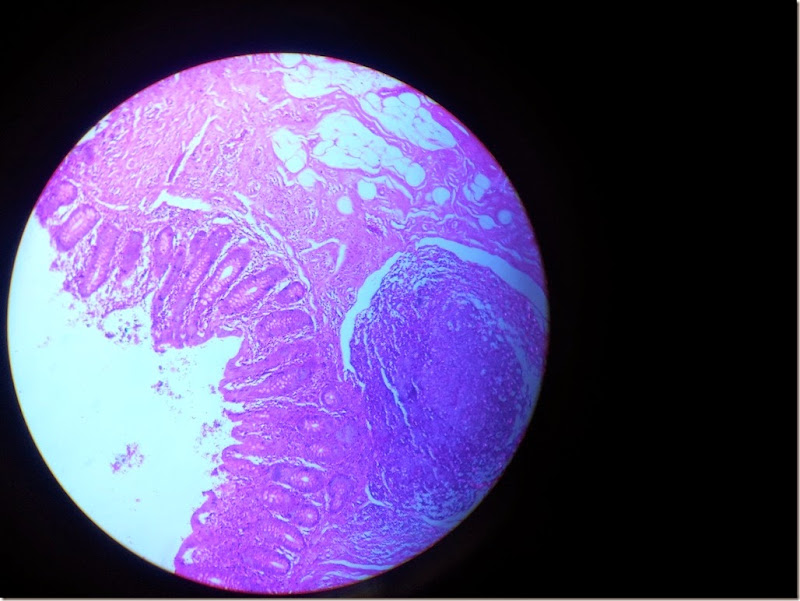 large_intestine_colon_Histology_slide