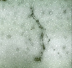 TEM Gold Labeled antibody applied to negatively stained Citrus Tristeza virus particle
