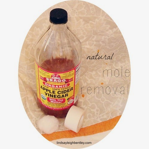home remedies for mole removal_2