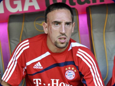 Franck-Ribery-Hairstyles-Picture1