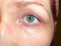 after removing eye makeup with SEPHORA Colletion Eye Makeup Remover Wipes (1)