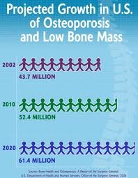 [osteoporosis%2520growth%255B5%255D.jpg]