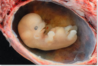 Human_Embryo_-_Approximately_8_weeks