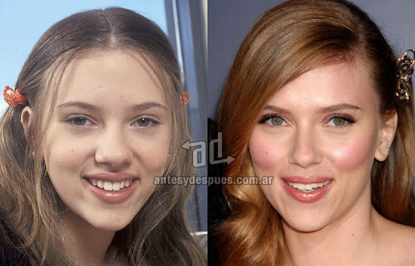 La nueva nariz operada de Scarlett Johansson