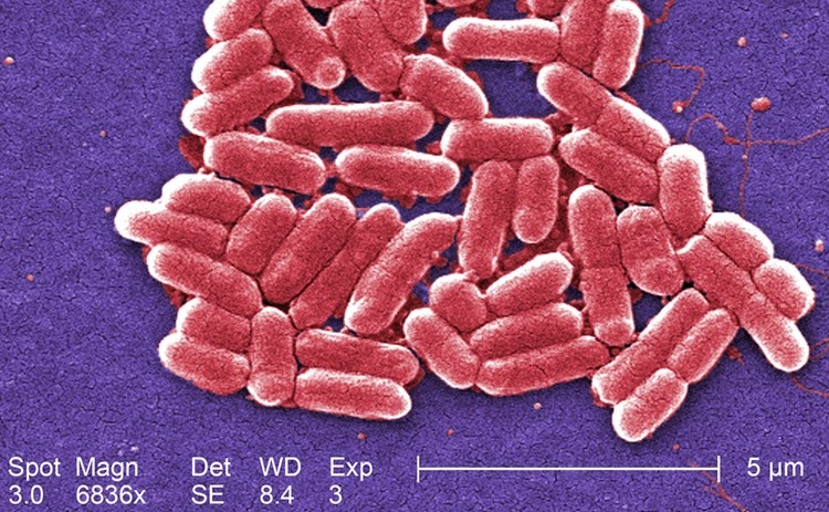 Micrografia Eletrônica de Escherichia coli O157:H7. Crédito: Janice Haney Carr/CDC