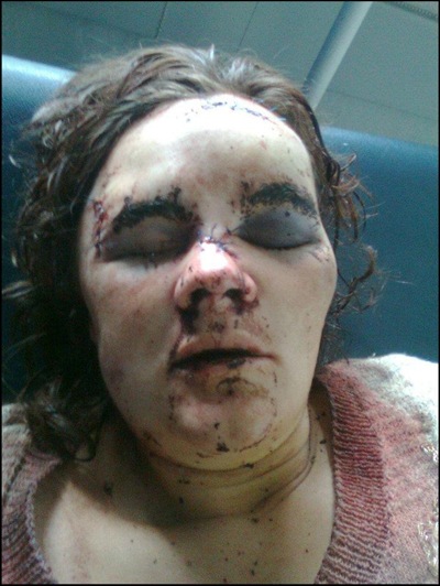 VanZyl Theresa assaulted with a hammer 7 months pregnant Jan 18 2012 baby died after birth TABITA