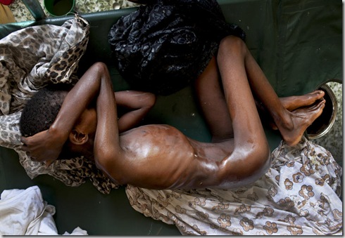 SOMALIA FAMINE 1