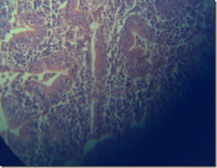 Purkinje cels high magnification under microscope