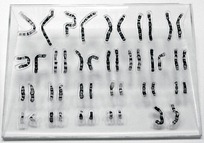 Chromosome puzzle 