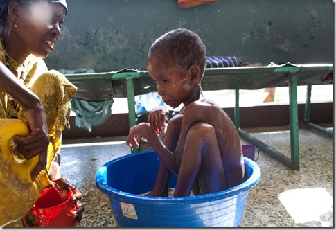 SOMALIA FAMINE 10