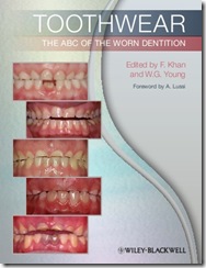 Toothwear