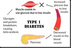 diabetes-type-1-symptoms