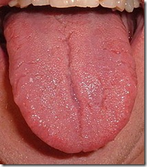 Tongue.agr