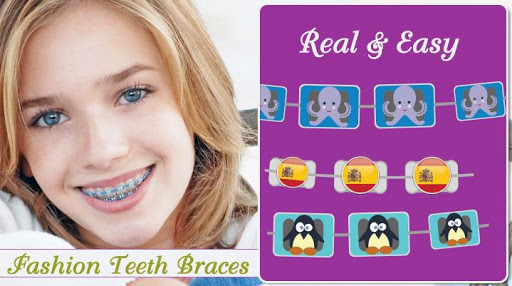 braces app