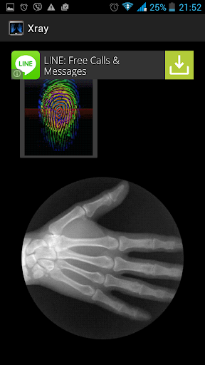 【免費娛樂App】xray scanner finger prank-APP點子