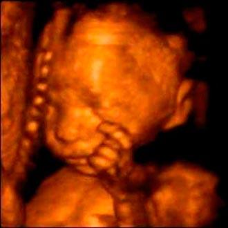 4d Ultrasound 3d and 2d