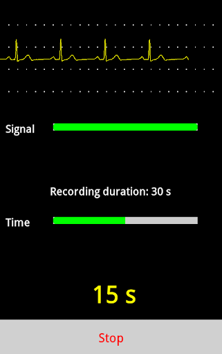 【免費醫療App】T-ECG Bioss User-APP點子