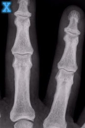 X-Ray Scanner Illusion Unlock poster 2