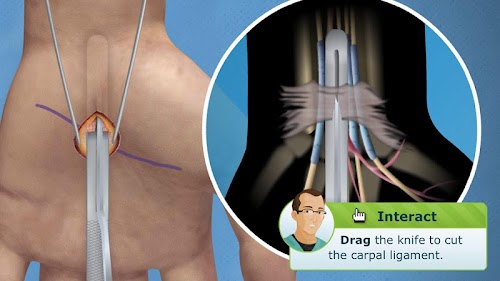 Android application Carpal Tunnel Surgery screenshort