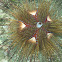 Radiant Sea Urchin