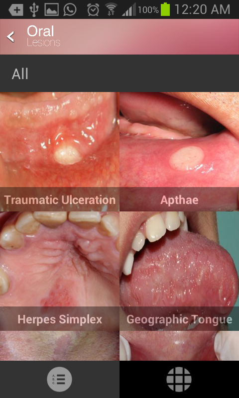 Oral Lesions Screen 2