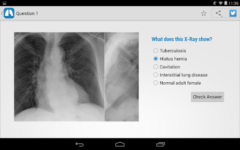 免費下載醫療APP|Chest X-Ray Training app開箱文|APP開箱王