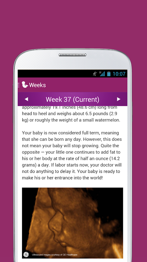   I'm Expecting - Grossesse – Capture d'écran 