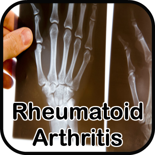 Rheumatoid Arthritis Treatment LOGO-APP點子