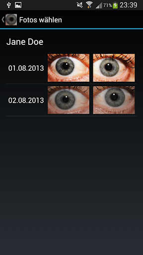 Eye Diagnosis