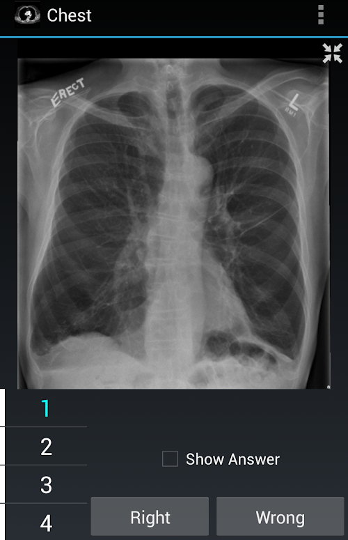 Android application Radiology Flashcards: Chest screenshort