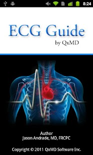 ECG Guide by QxMD