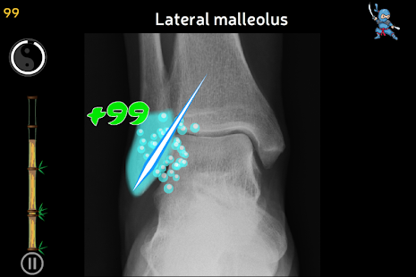 Anatomy Ninja Lower Limb - náhled
