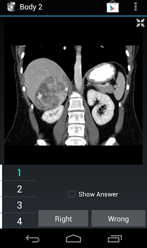 【免費醫療App】Radiology Flashcards: Body 3-APP點子