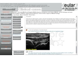 Ultrasound APK صورة لقطة الشاشة #3