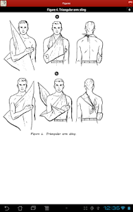 Bandaging and Splinting Screenshots 11
