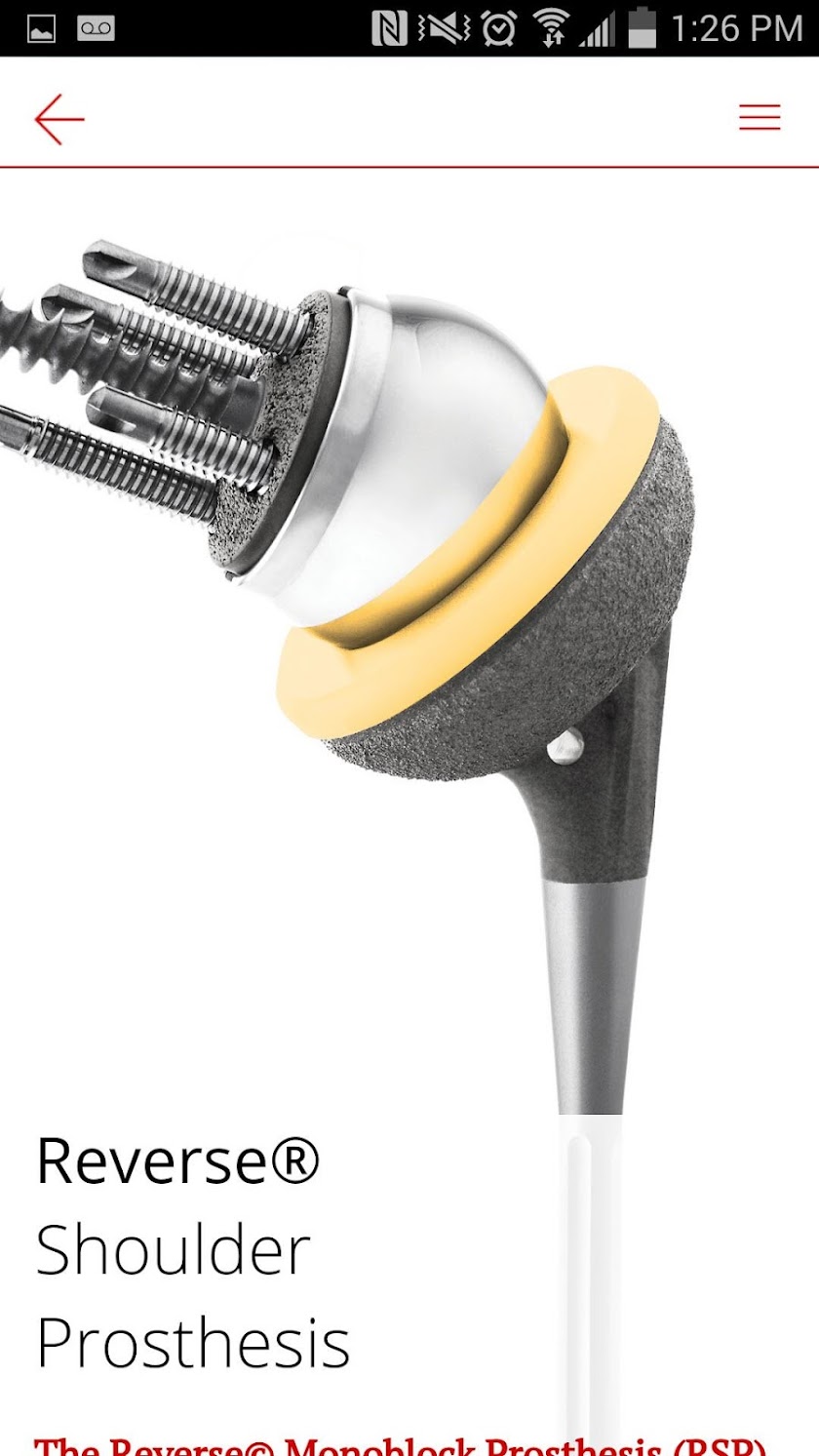DJO Surgical Screen 2