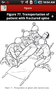 Bandaging and Splinting Screenshots 6